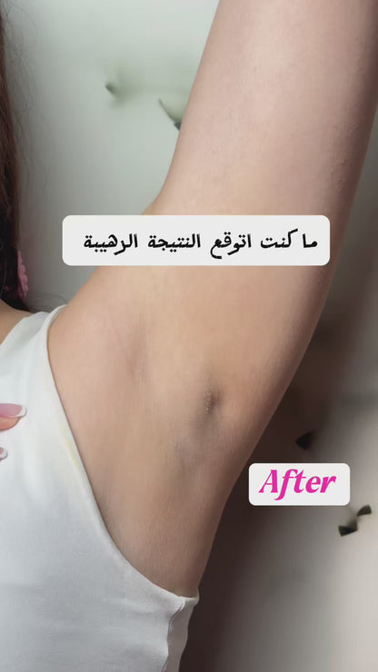 كريم تفتيح منطقة البكيني وتحت الإبط – عناية فعالة للمناطق الحساسة